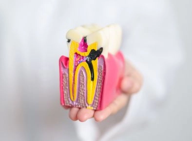 A tooth model
